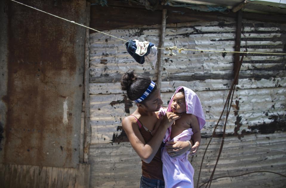 In this photo taken July 25, 2019, 15-year-old Karelys Herrera holds her baby after giving him a bath behind her home in the Caucaguita neighborhood on the outskirts of Caracas, Venezuela. Herrera said she contemplated suicide after learning she was pregnant at 14 years old. (AP Photo/Ariana Cubillos)