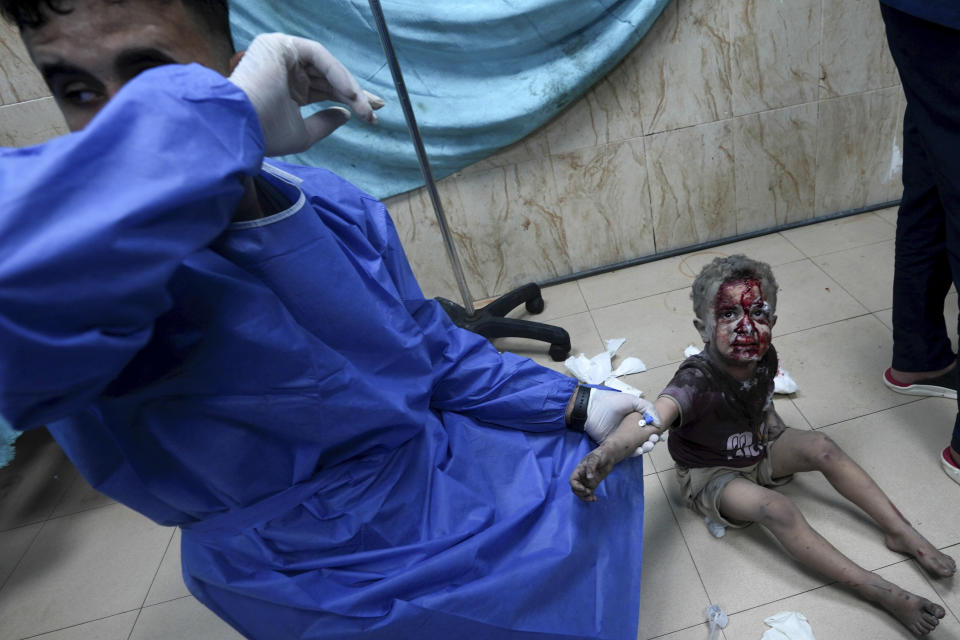 A medic helps a child wounded in the Israeli bombardment of the Gaza Strip in a hospital in Deir Al-Balah, Tuesday, Oct. 24, 2023. (AP Photo/Adel Hana)