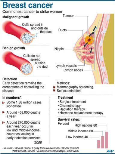 Fact file on breast cancer. Angelina Jolie, 37, wrote in an opinion piece entitled "My Medical Choice" in The New York Times that she had chosen a double mastectomy because she carries a faulty gene that increases her risk of both breast and ovarian cancer