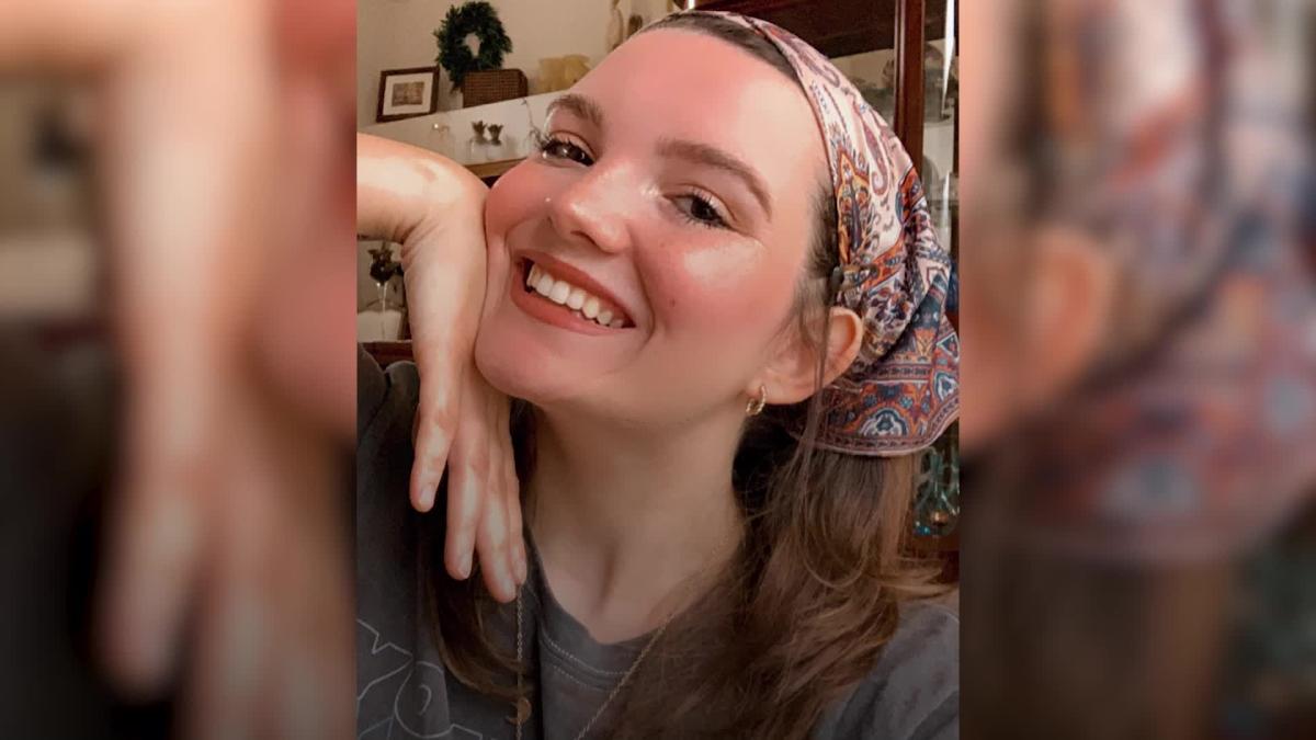 Une étudiante qui s’évanouit «presque à chaque fois» qu’elle quitte la maison devient la star de TikTok