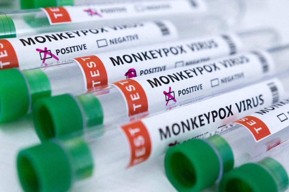 Monkeypox tests  (REUTERS)