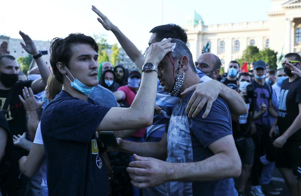 injured protesters serbia.JPG