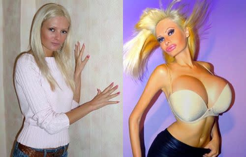 Before and after: model Victoria Wild. <i>Photo: Twitter/@VictoriaWildxxx</i>