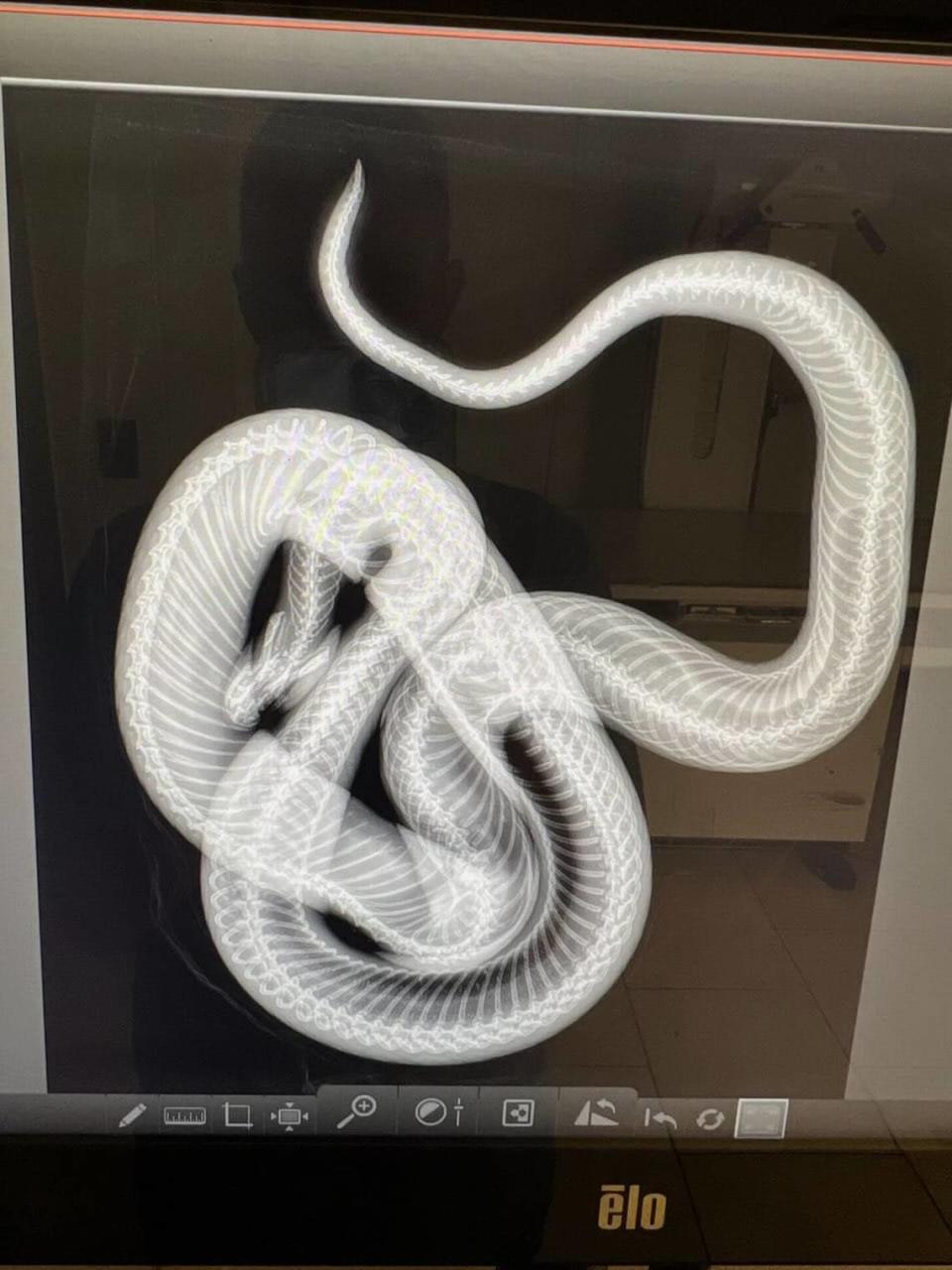 A Rainbow snake was recently rescued, x-rayed and released back into the wild. The x-ray revealed signs of an old spinal injury, but nothing life-threatening.