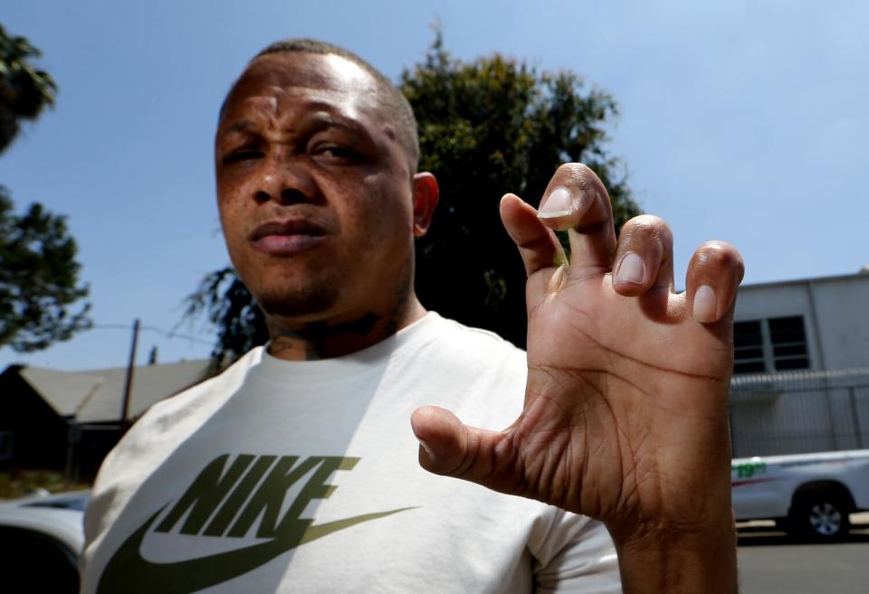 Dexter White has limited use of his left hand after getting shot by LAPD officers in 2018.