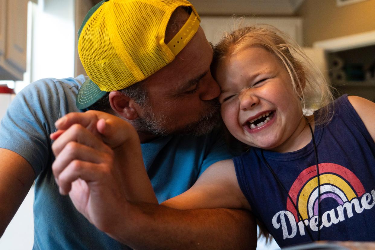 Casey McPherson kisses his daughter Rose, 7, at their Austin home. Rose has a rare genetic mutation known as H2, which has caused her to lose her ability to talk and makes other physical activities, like walking, difficult. McPherson created a foundation called “To Cure a Rose” that is dedicated to finding a cure for rare genetic diseases like H2. “I went from escaping life to trying to save it,” McPherson said.