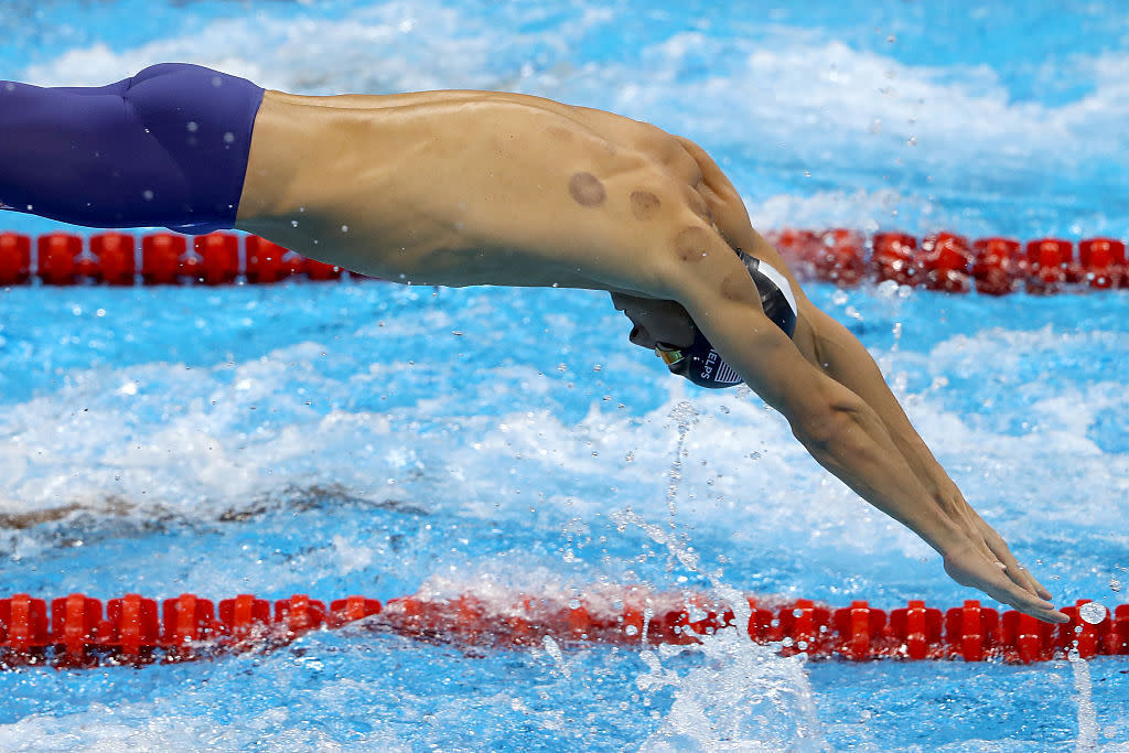 Michael Phelps is one of many Olympians to show off cupping bruises at the Rio games. (Photo: Getty)