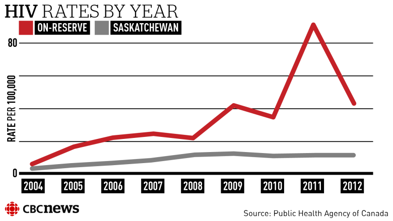 HIV epidemic sweeping Saskatchewan reserves