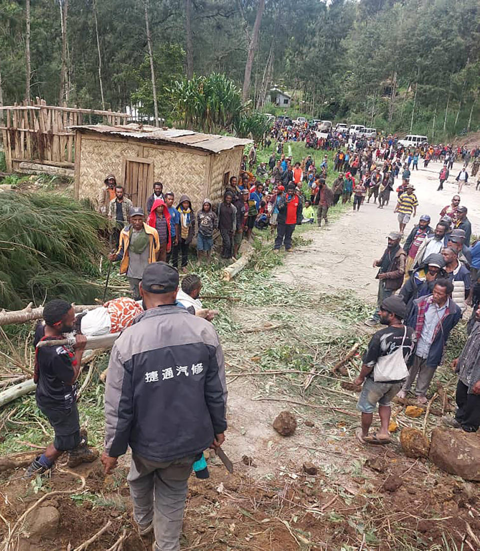 In this photo provided by the International Organization for Migration, an injured person is carried on a stretcher to seek medical assistance after a landslide in Yambali village, Papua New Guinea, Friday, May 24, 2024. More than 100 people are believed to have been killed in the landslide that buried a village and an emergency response is underway, officials in the South Pacific island nation said. The landslide struck Enga province, about 600 kilometers (370 miles) northwest of the capital, Port Moresby, at roughly 3 a.m., Australian Broadcasting Corp. reported. (Benjamin Sipa/International Organization for Migration via AP)