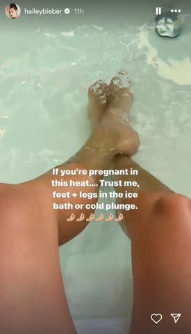 <p>Hailey Bieber/Instagram</p> Hailey Bieber legs in an ice bath