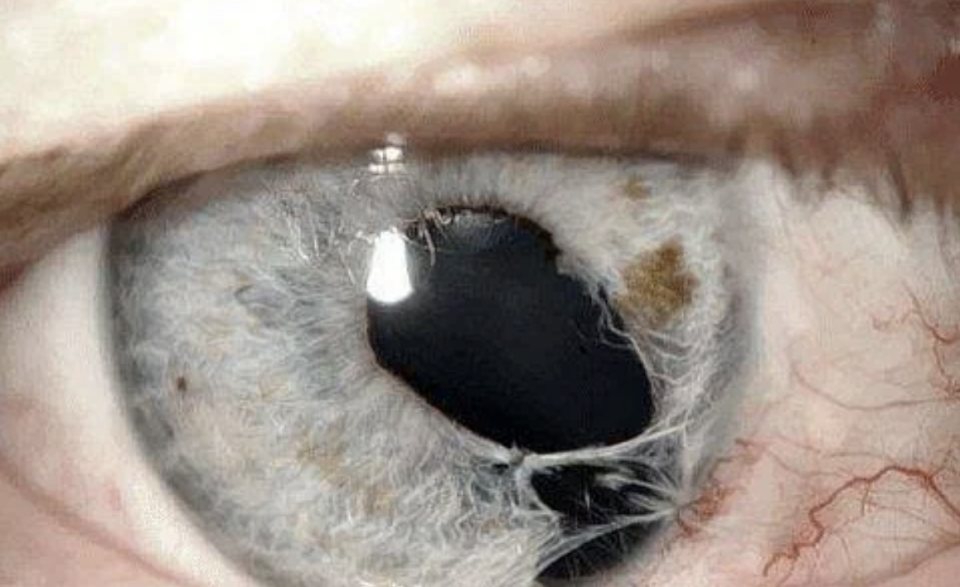 Close-up of a human eye with a reflection on the cornea