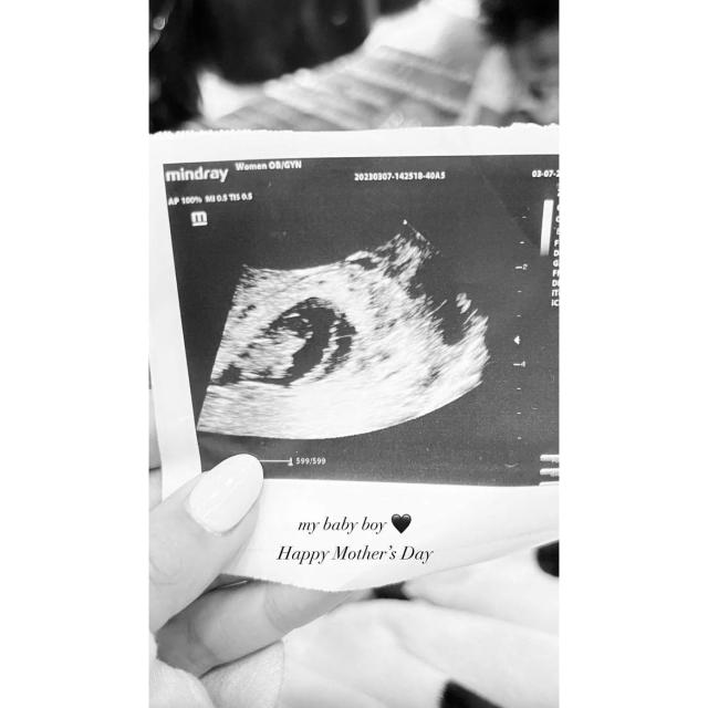 Vanessa Morgan Posts Sonogram of Her Baby Boy Amid Divorce