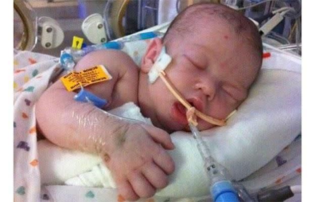 Landon was placed on life support after just three days. Photo: Supplied