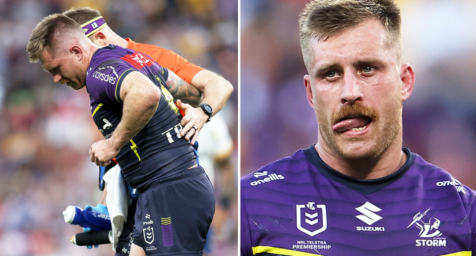 Melbourne Storm five-eighth Cameron Munster has revealed he'll undergo surgery on both hips at the end of the season. Pic: Getty