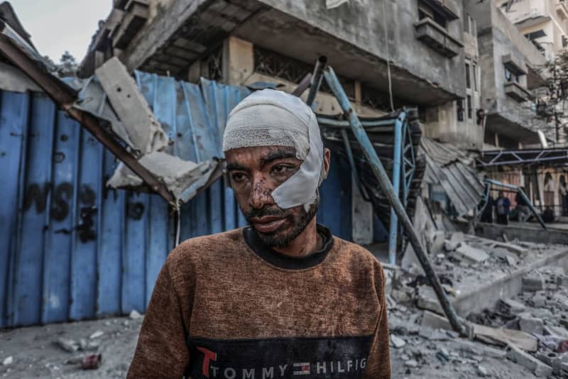 The Palestinian Ahmed Al-Sufi with a bandaged head looks on in the aftermath of an Israeli air strike, amid the ongoing conflict between Israel and the Palestinian militant group Hamas. Abed Rahim Khatib/dpa