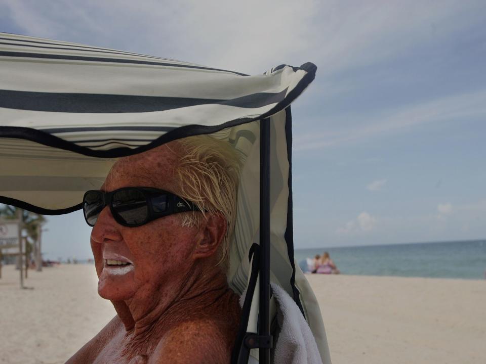 A man wears zinc oxide, which looks white, on his lips as he sits on the beach.