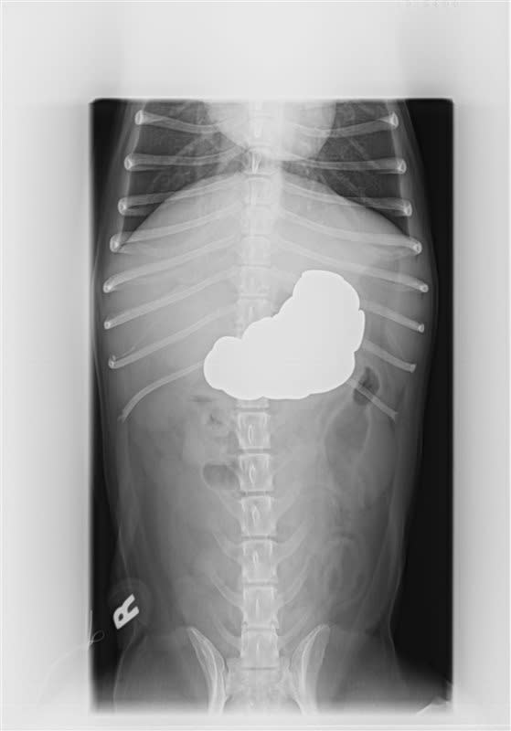 This March 8, 2013 image provided by BluePearl Veterinary Partners shows an X-ray of Jack a dog who swallowed pennies, in New York, New York. Hundreds of pets undergo surgery every year to remove items, including panties and bras from their stomachs and intestines. Dr. Amy Zalcman at BluePearl Veterinary Partners in New York used a camera attached to a net to fish 111 pennies out of Jack's stomach. Scooping up five at a time, it took a couple of hours. (AP Photo/BluePearl Veterinary Partners)