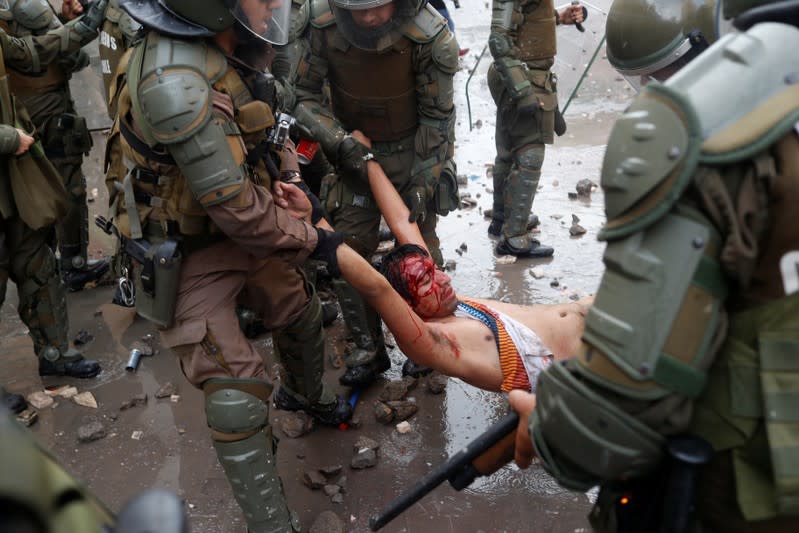 MATERIAL SENSIBLE - Un manifestante herido es cargado por efectivos de las fuerzas de seguridad durante una protesta en Santiago