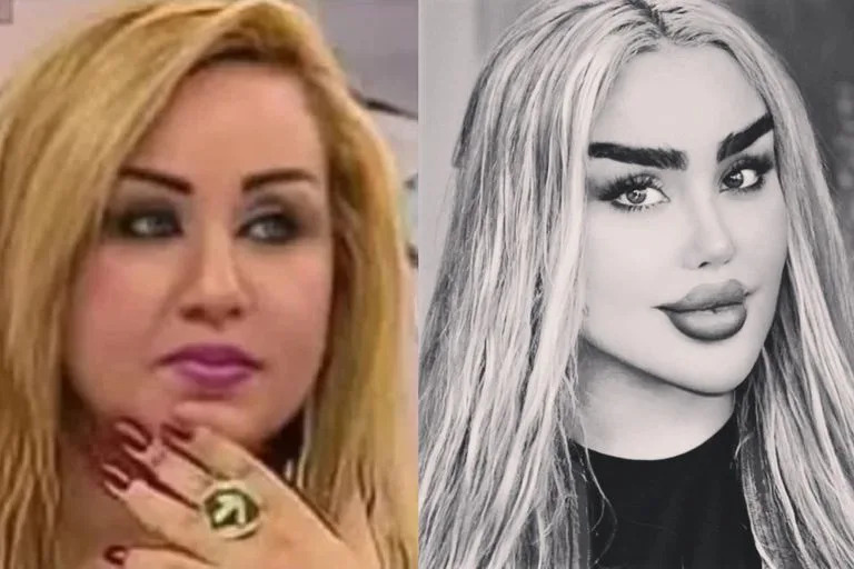 El antes y después de Dalia Naeem, la actriz se realizó 43 cirugías para parecerse a Barbie