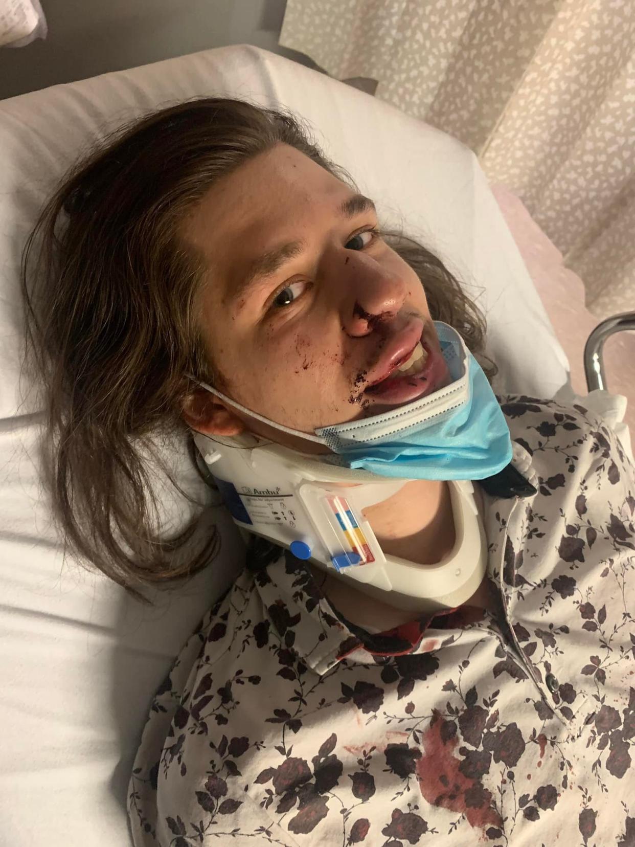 Adam Neufell, a drummer for a Worcester-based rock band, is hospitalized after being assaulted in Boston.