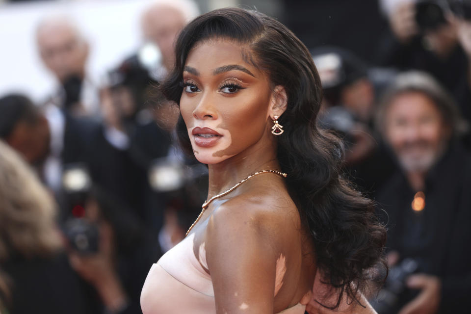 Winnie Harlow poses for photographers upon arrival at the premiere of the film 'Elvis' at the 75th international film festival, Cannes, southern France, Wednesday, May 25, 2022. (Photo by Vianney Le Caer/Invision/AP)