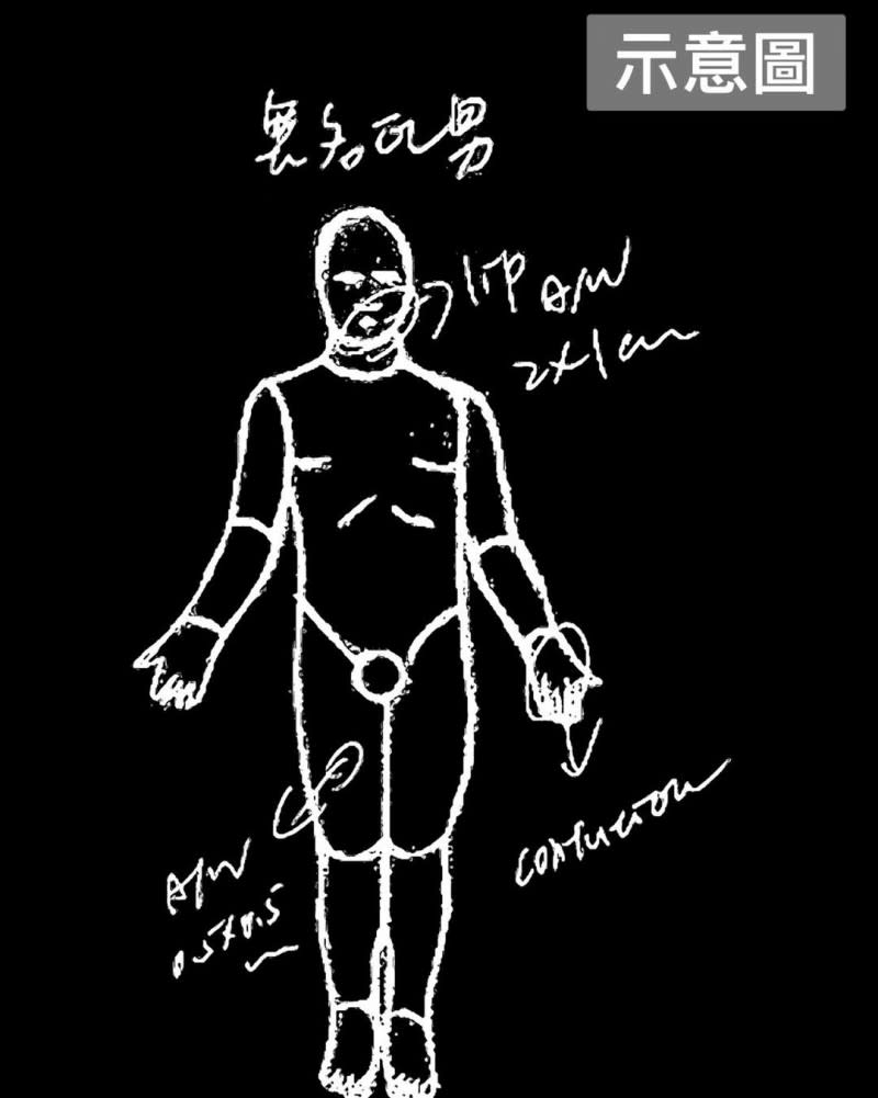 高大成先前也公開的賴男驗傷單的示意圖。（圖／翻攝自FB／高大成）