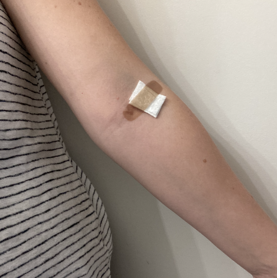 the author's arm with a Band-Aid on it
