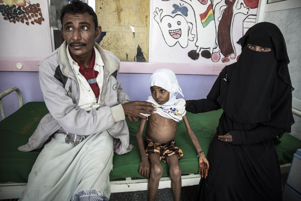 In this Nov. 15, 2018 photo, 10-year-old Affaf, who weighs 9,6 kg (21 pounds), sits with her parents at a hospital in Hajjah, Yemen. The U.N. food agency said Thursday, Dec. 6, 2018 it is planning to rapidly scale up food distribution to help another 4 million people in Yemen over the next two months, more than a 50-percent increase in the number reached now, if access can be maintained in the poor, war-stricken country. (Marco Frattini/WFP via AP)