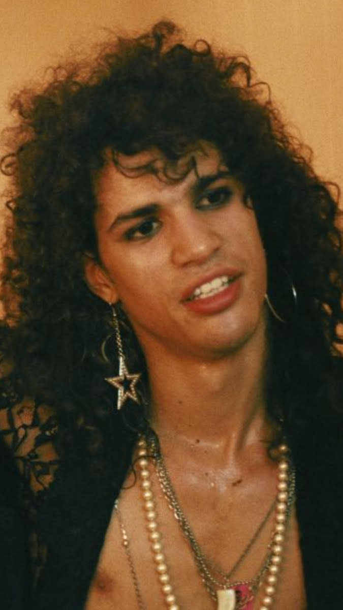 Slash backstage at a show in the mid-'80s