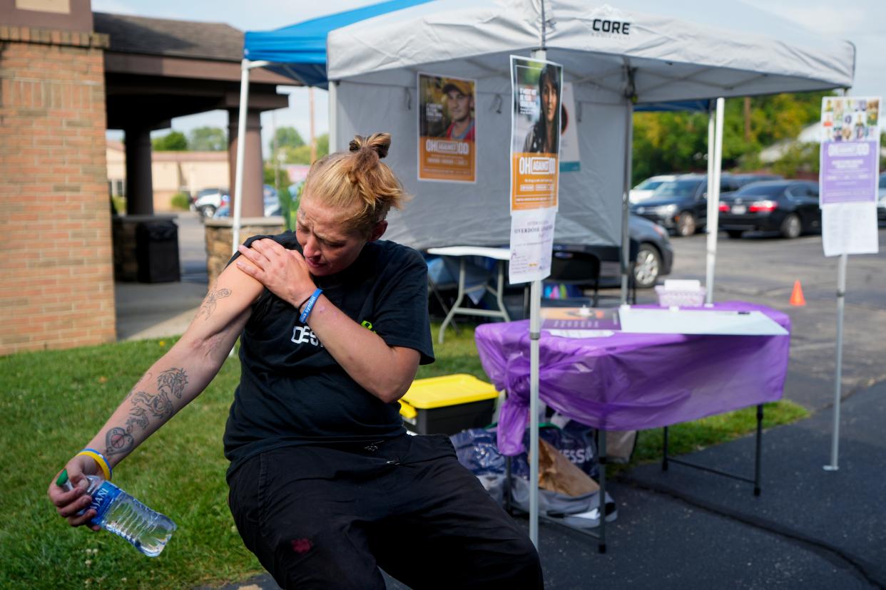 Drea Hamilton, 31, of Hamilton, shows a large scar on her arm where she had an infected wound caused by intravenous drug use. Emmitt gets help every week at the Middletown-based harm reduction site, but it is set to close Sept. 1. "I'm dreading its closing," she said.