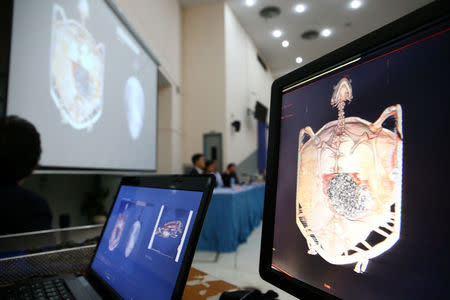 Screens show a CT scan of Omsin, a 25 year old femal green sea turtle, during a news conference at the Faculty of Veterinary Science, Chulalongkorn University in Bangkok, Thailand March 6, 2017. REUTERS/Athit Perawongmetha