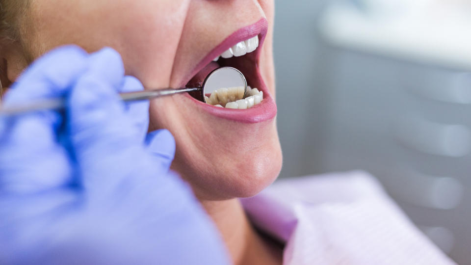 What are the warning signs of oral cancer? (Image via Getty Images)