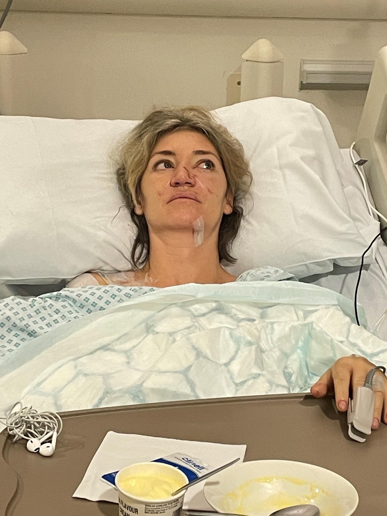 Sarah de Lagarde, pictured in hospital a few weeks after her accident in 2022. (Supplied)