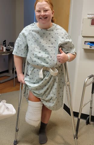 <p>Sierra Diller</p> Sierra Diller after getting her right foot amputated on Dec. 8