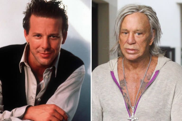 Mickey Rourke se sometió a múltiples cirugías estéticas, la mayoría de ellas, en el rostro