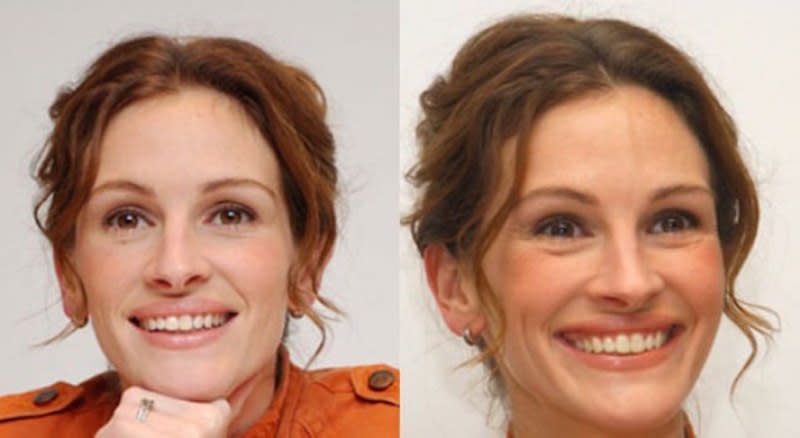 Julia Roberts fake smile