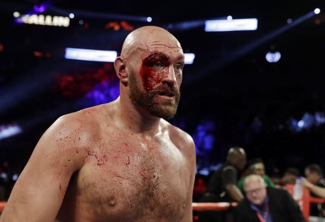 Tyson Fury was badly cut during his contest against Otto Wallin