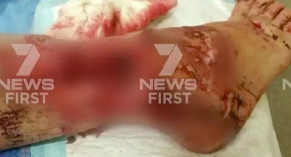 Ms Rundle said ‘there was blood everywhere’. Source: 7 News