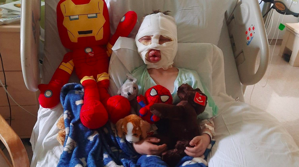 Dominick Krankall, 6, was set on fire by bullies in  Bridgeport, Connecticut and left with second and third-degree burns covering his small frame, his family says (Go Fund Me/Kayla Deegan)