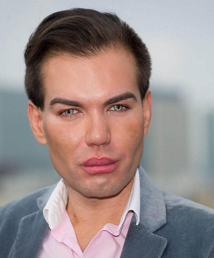 There’s a Guy Trying to Look Like a Ken Doll - and It’s Not Going Well