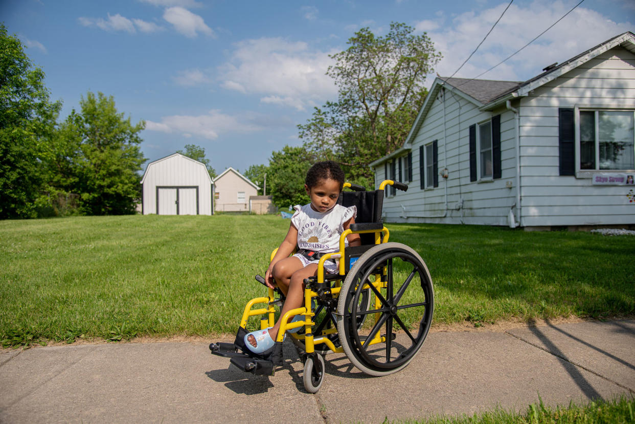 Skye McBride sits in a wheelchair outdoors (Cydni Elledge for NBC News)