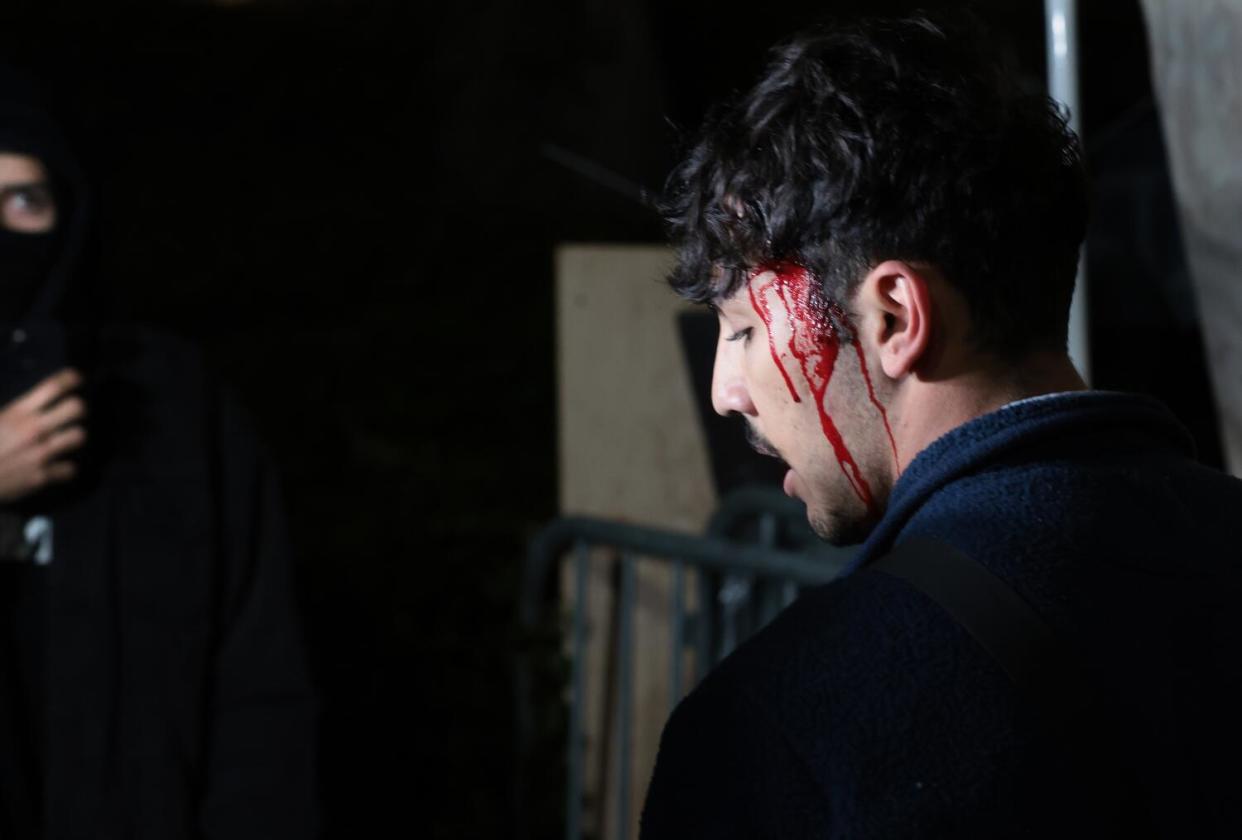 A pro-Palestinian demonstrator bleeds from his head.