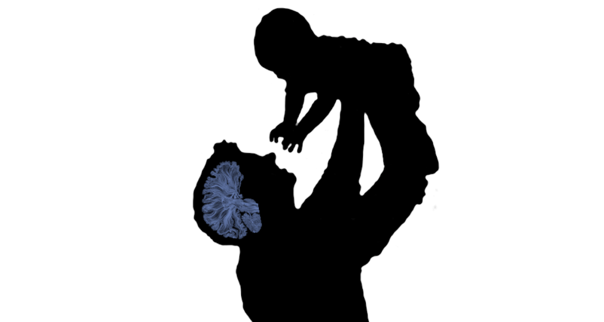 Fathers' brains adjust their structure and function to parenthood María Paternina-Die, <a href="http://creativecommons.org/licenses/by-nd/4.0/" rel="nofollow noopener" target="_blank" data-ylk="slk:CC BY-ND;elm:context_link;itc:0;sec:content-canvas" class="link ">CC BY-ND</a>