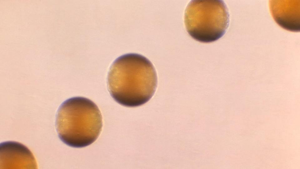 <div>This 1966 microscope photo shows five colonies of Group-B Neisseria meningitidis bacteria. On Thursday, March 28, 2024, the CDC issued an alert to U.S. doctors about an increase in cases of one type of invasive meningococcal disease, mostly due to the serogroup Y strain of the bacteria. Four hundred and twenty two cases were reported in 2023, which was the most in a single year since 2014. There have been 143 reported this year so far. (Dr. Brodsky/CDC via AP)</div> <strong>(AP Images)</strong>