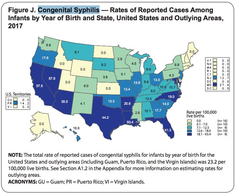 Western and Southern states had the highest rates of congenital syphilis in the U.S. (Photo: Centers for Disease Control And Prevention: STD Surveillance 2017)