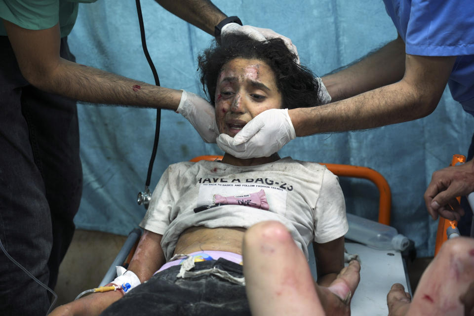 A Palestinian child wounded in Israeli bombardment is treated in a hospital in Deir al-Balah, southern Gaza Strip, Tuesday, Oct. 17, 2023. (AP Photo/Hatem Moussa)