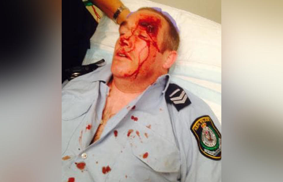 A senior constable sustained a large laceration to his head when he was attacked and pushed down the stairs while responding to a call-out at Muswellbrook. Source: NSW Police Association