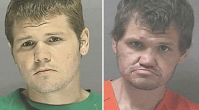 This 32-year-old man was arrested for selling methamphetamines. His drug use has resulted in him looking significantly older, loosing all his teeth and cartilage in his nose. Photo: Supplied