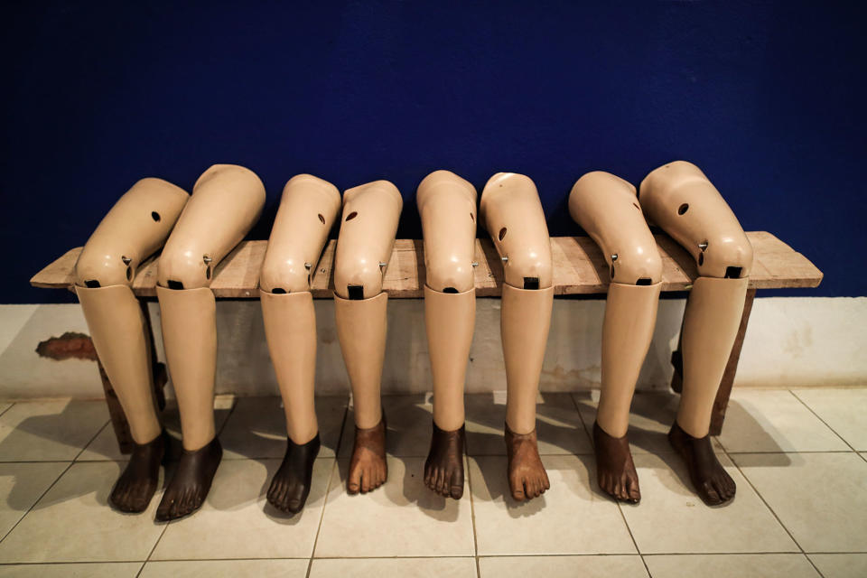 Leg prostheses on display in Vientiane, Laos