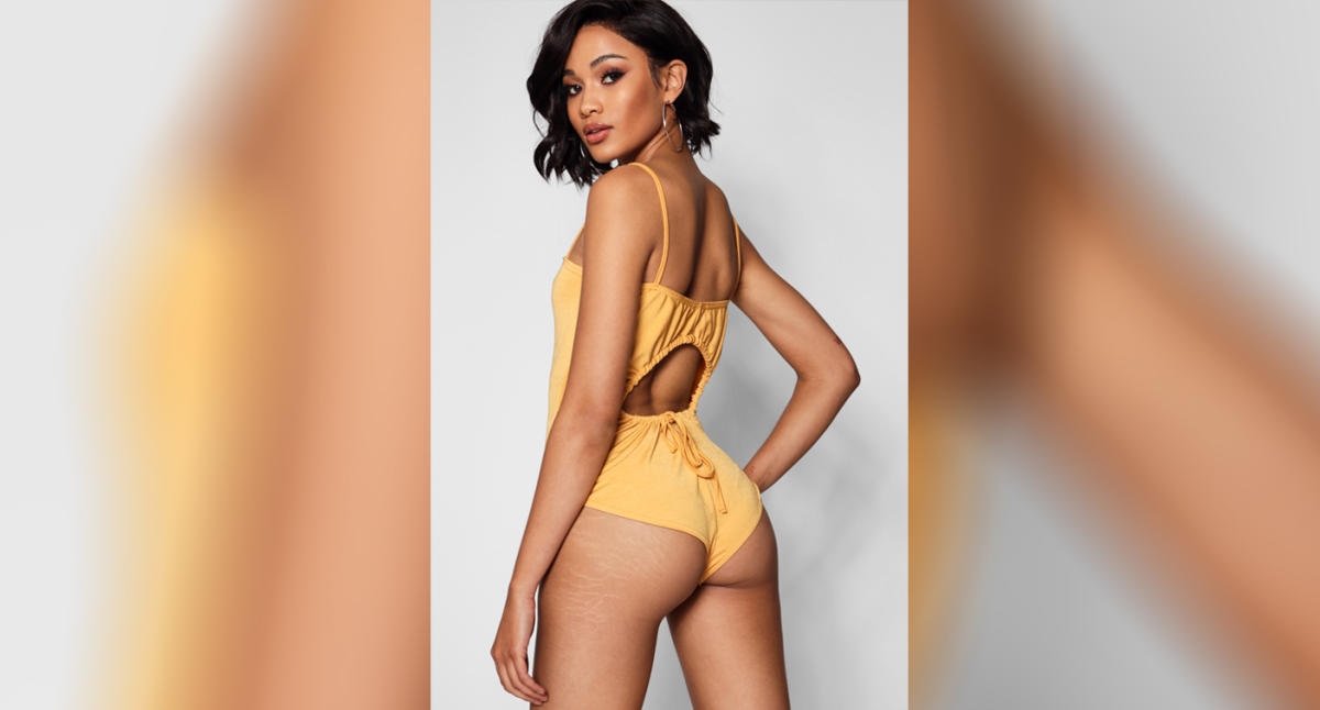 Asos Is Featuring Swimsuit Models with Stretch Marks and Acne Scars